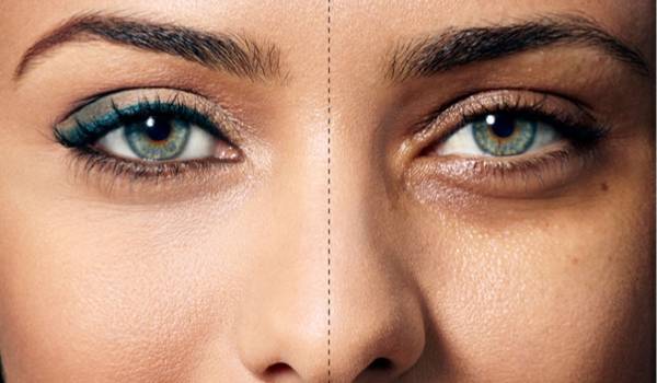 درمان سیاهی دور چشم با روش‌های طب سنتی | مجله آنلاین کاکوتی